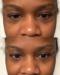 Customer photo review of Medicube Kojic Acid Turmeric Eye Serum