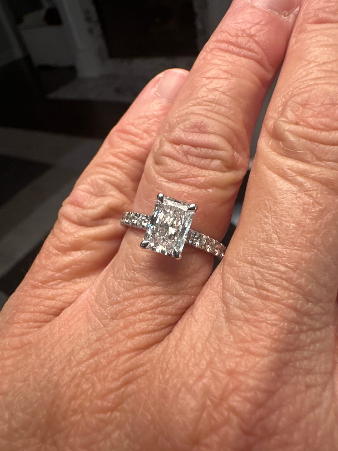 Customer photo review of 2.5mm Band