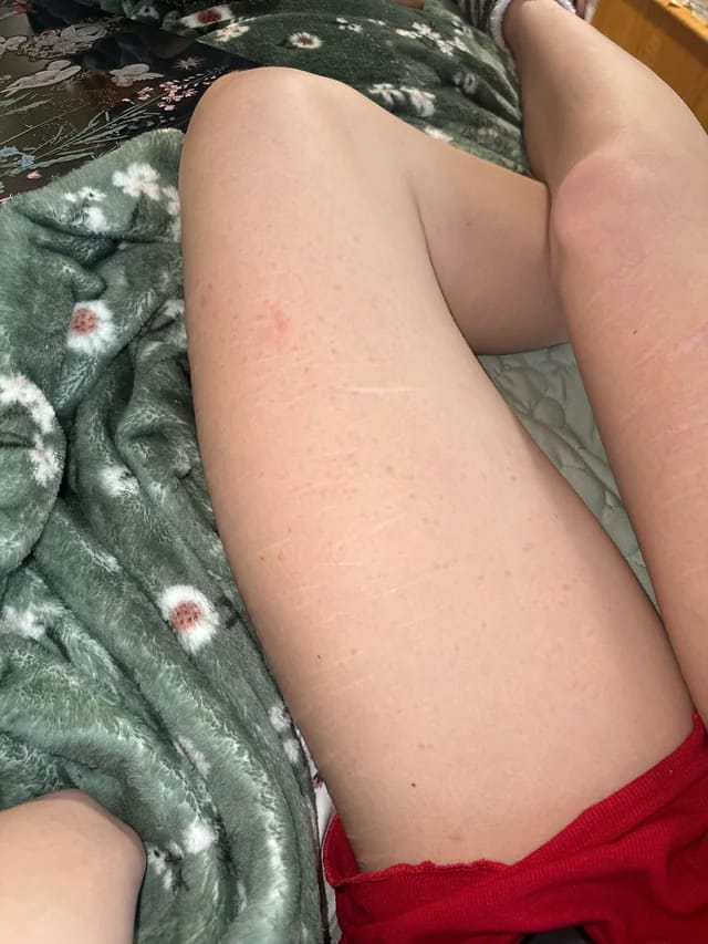 Customer photo review of Bump-Free Shaver