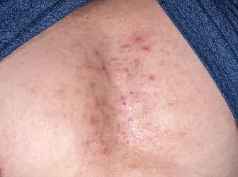 Customer photo review of LumiDew™ Skin Essence