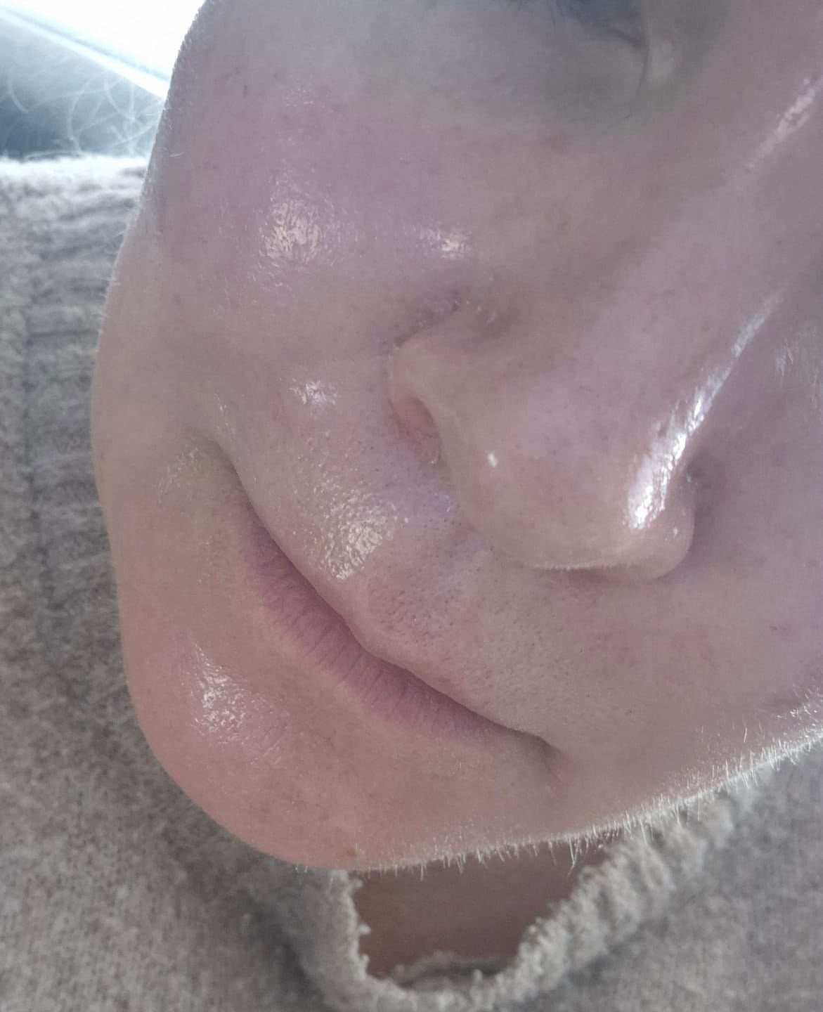 Customer photo review of Luvum Slow Aging Phyto Collagen Wrapping Mask (80ml)