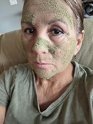 Customer photo review of PoreDew™ Mud Mask