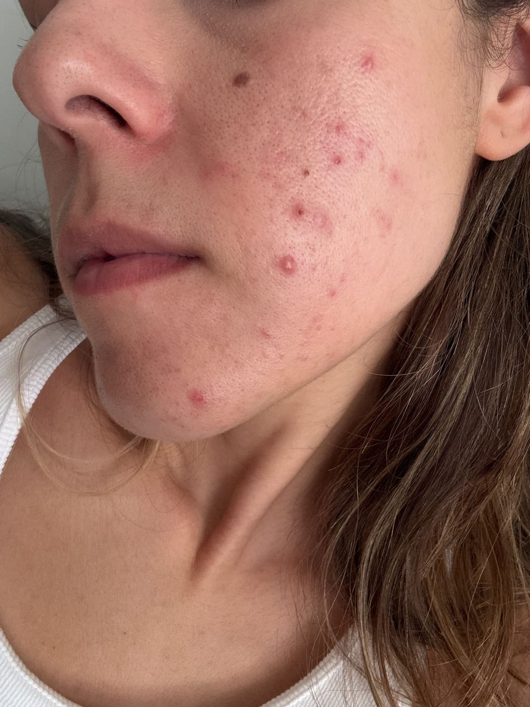 Customer photo review of A CONTROL + CORTIZEN - Equilibrio hormonal desde el cerebro, los ovarios, la piel y el metabolismo.