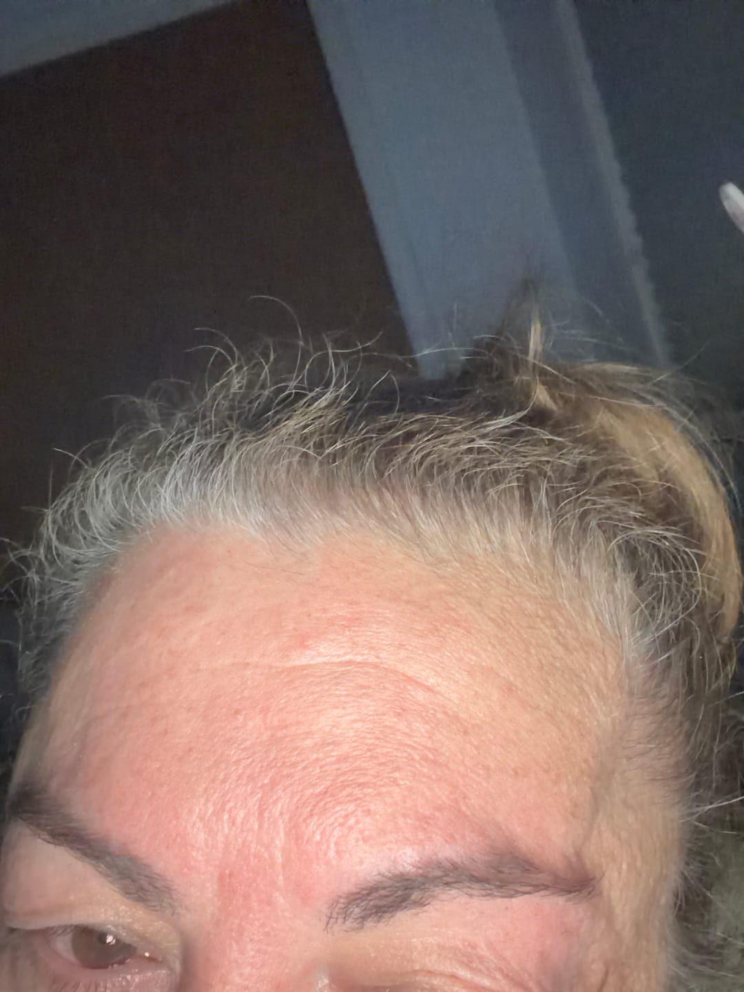 Customer photo review of Instant Dye Shampoo