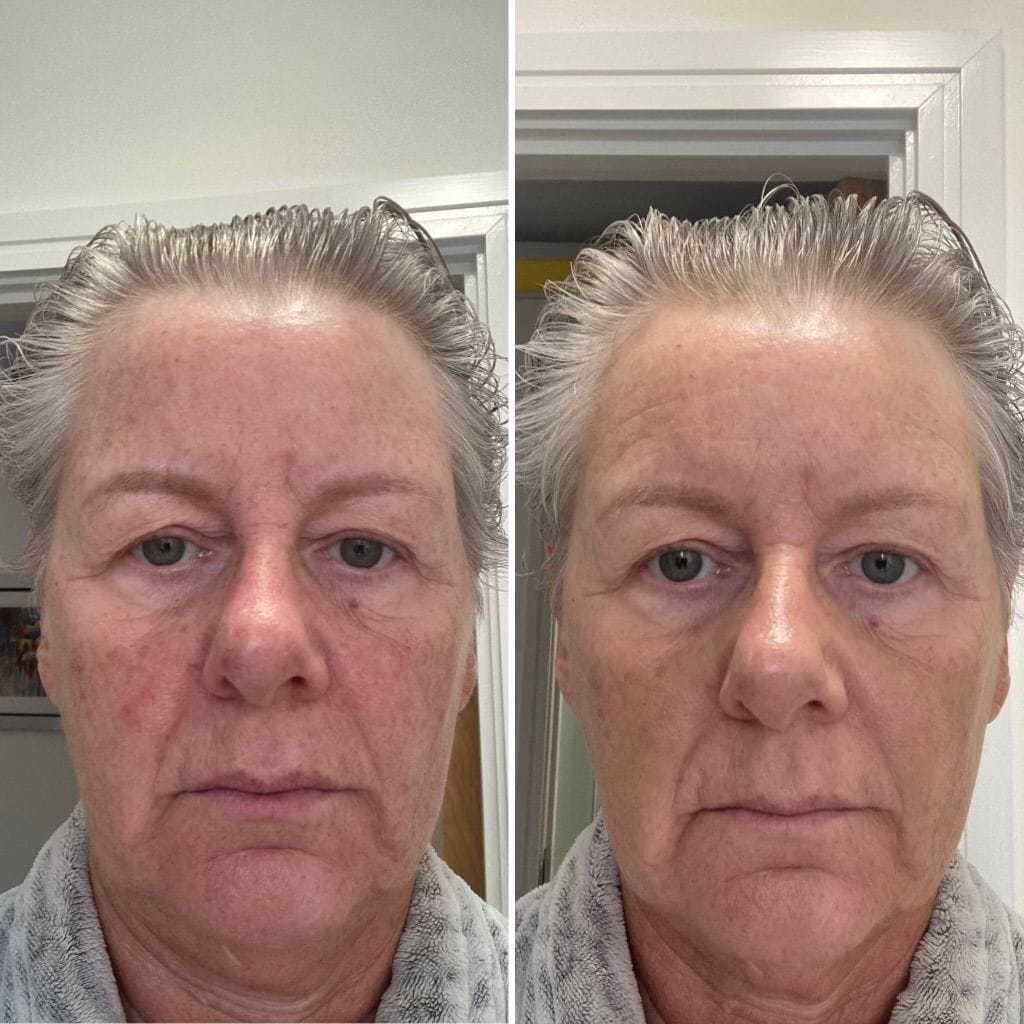 Customer photo review of FREE Sample Pack Duo (just pay shipping)