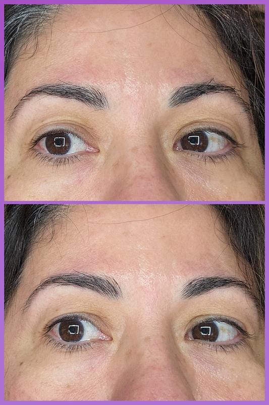 Customer photo review of Instant FIRMx® Peter Thomas Roth Tensor de Ojos Temporal