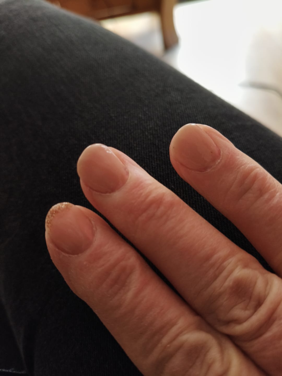 Customer photo review of Glowdip Alles-in-één Manicure Set