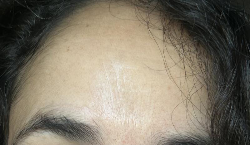 Customer photo review of Instant FIRMx® Peter Thomas Roth Tensor de Ojos Temporal