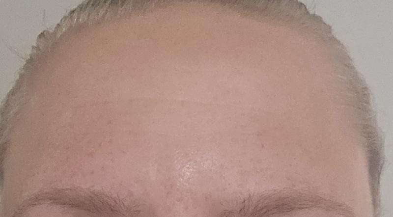 Customer photo review of Instant FIRMx® Peter Thomas Roth Tensor de Ojos Temporal