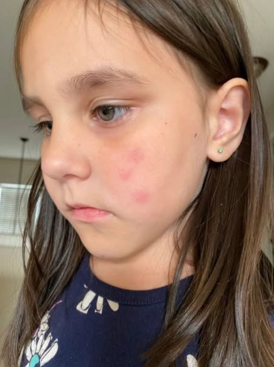 Customer photo review of PestGuard