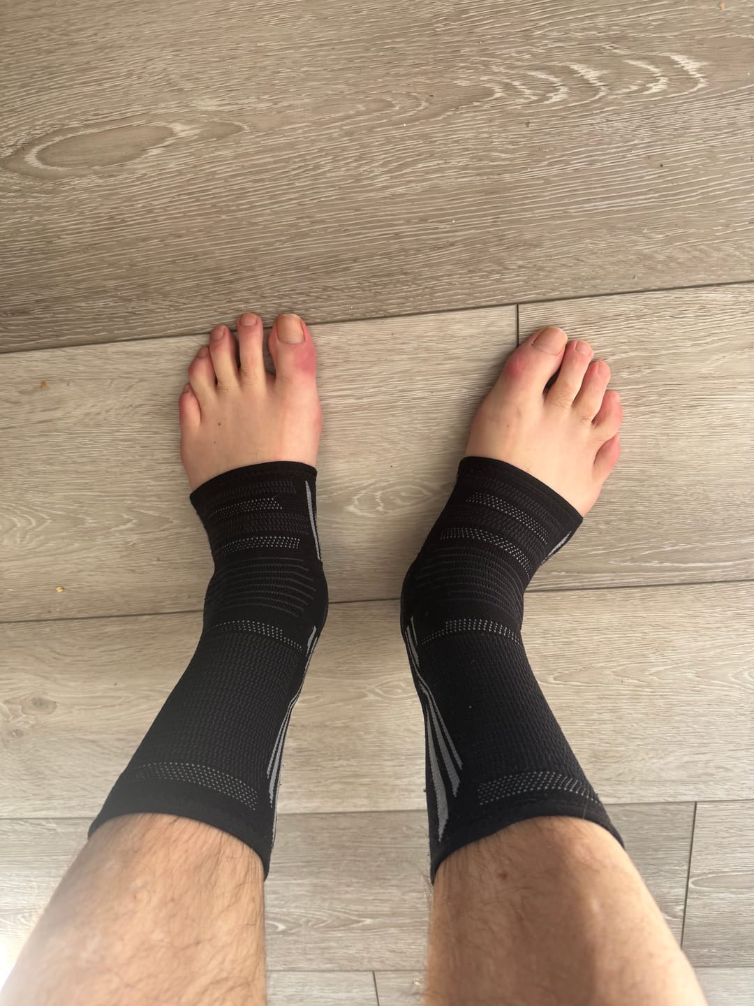 Customer photo review of Ankle Compression Supports