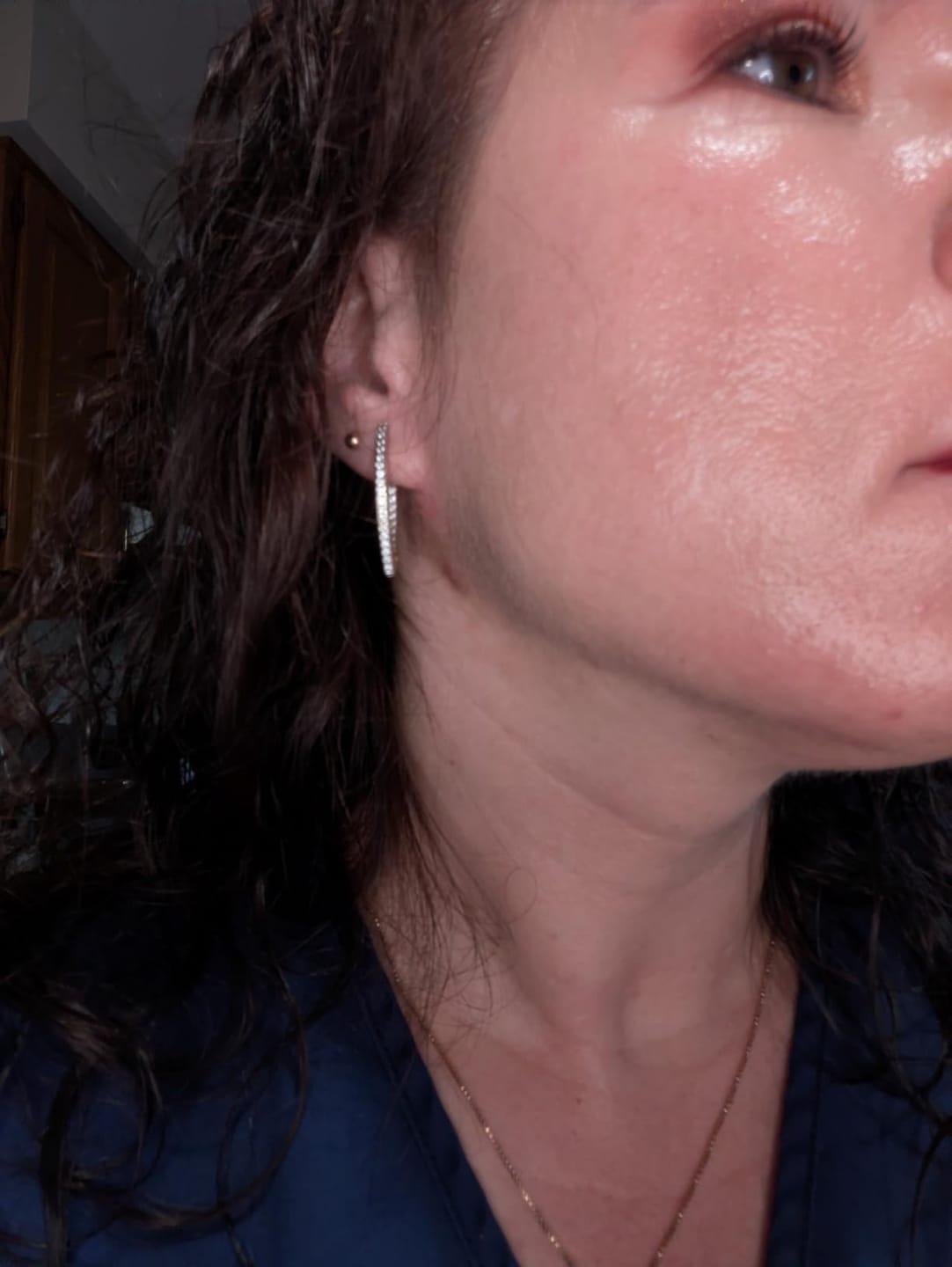 Customer photo review of TrueTone CC Serum