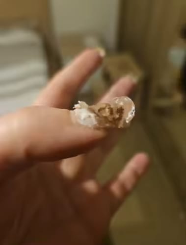 Customer photo review of Removedor de gel de uñas