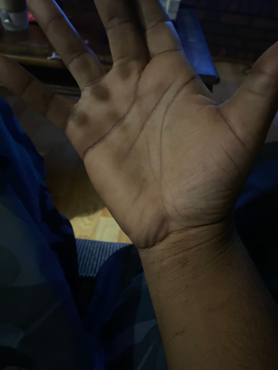 Customer photo review of SHIPPING PROTECTION