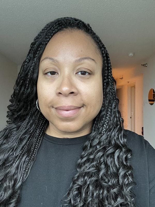 Customer photo review of Instant FIRMx® Peter Thomas Roth Tensor de Ojos Temporal