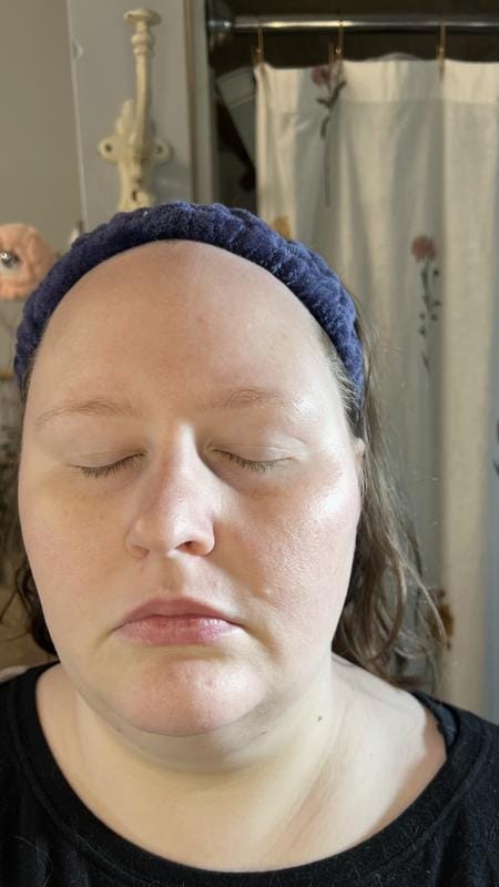 Customer photo review of Instant FIRMx® Peter Thomas Roth Tensor de Ojos Temporal