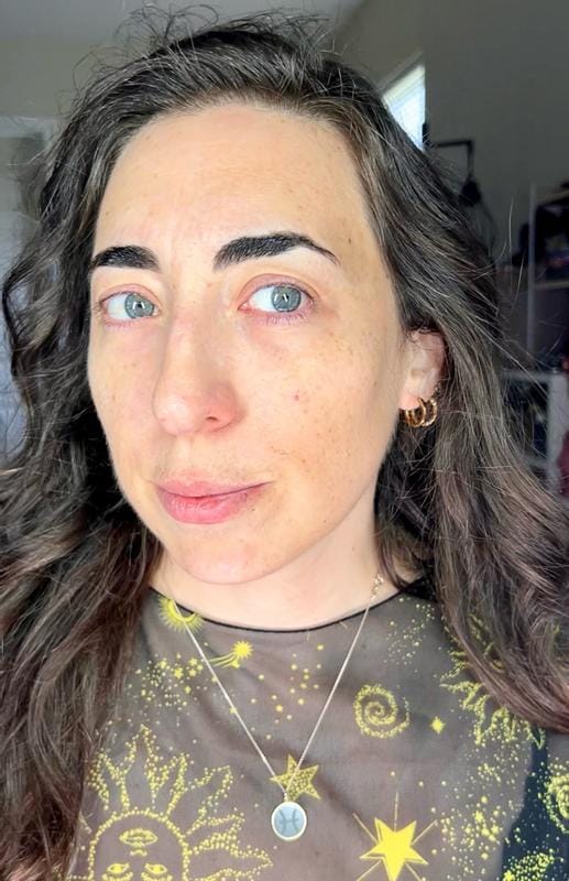 Customer photo review of Instant FIRMx® Peter Thomas Roth Tensor de Ojos Temporal