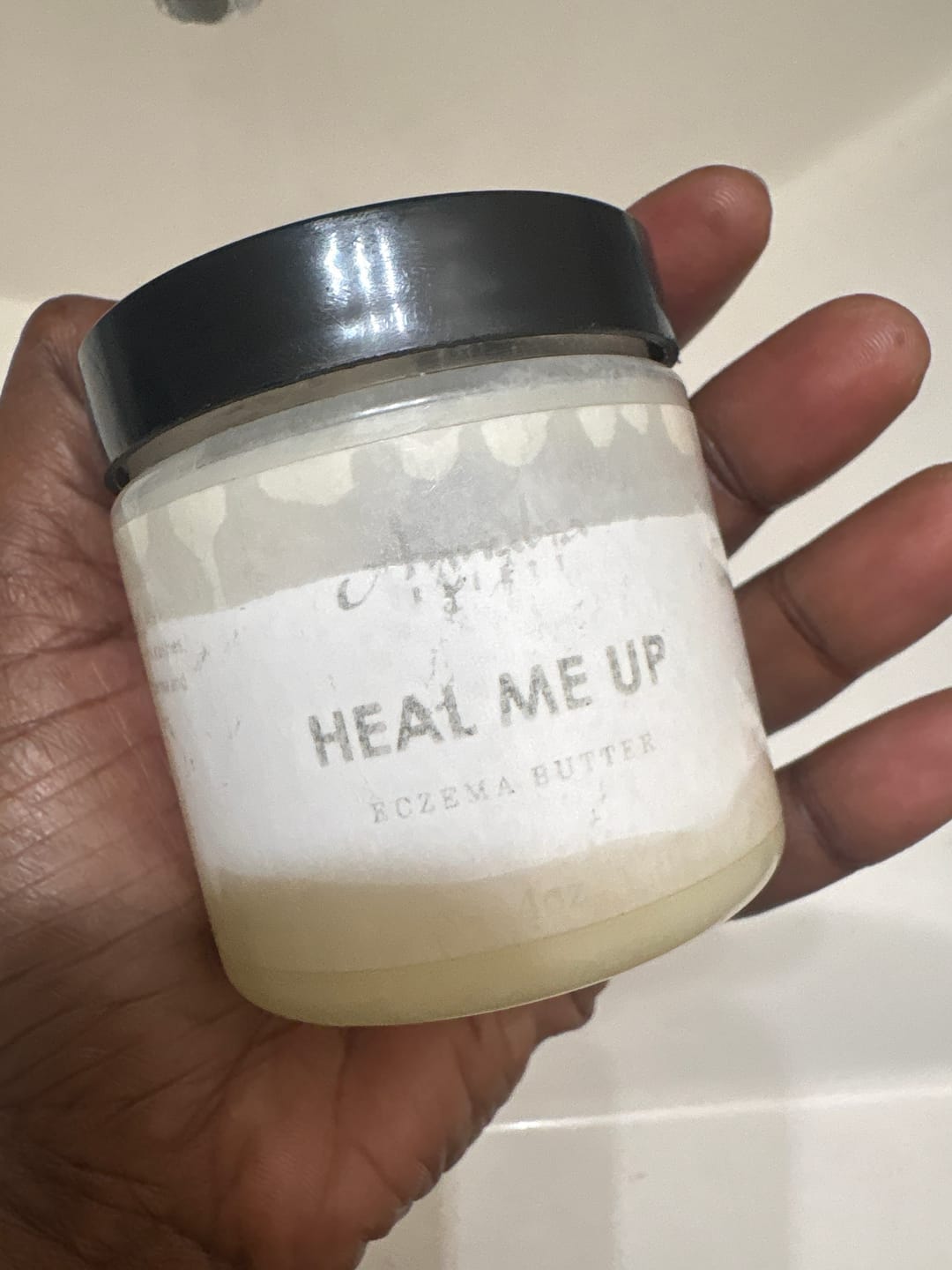 Customer photo review of Heal Me Up Eczema Butter