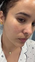 Customer photo review of NiaLumi™ Brightening Serum