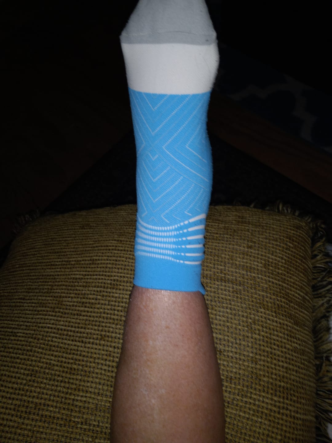 Customer photo review of Hand-Foot Syndrome Cream for Chemo-Related Skin Problems