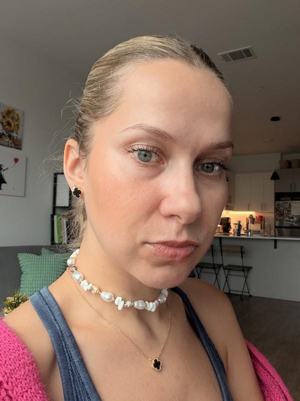 Customer photo review of Instant FIRMx® Peter Thomas Roth Tensor de Ojos Temporal