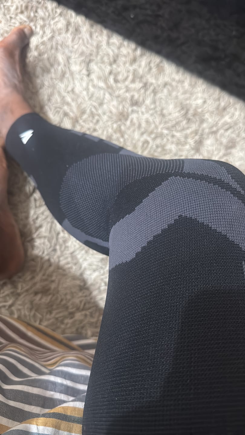 Customer photo review of Compression Sleeves V2 for Knees and Legs