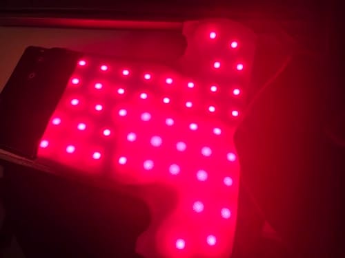 Customer photo review of Red Light Therapy Cap™ – LED Light Therapy for Skin & Scalp