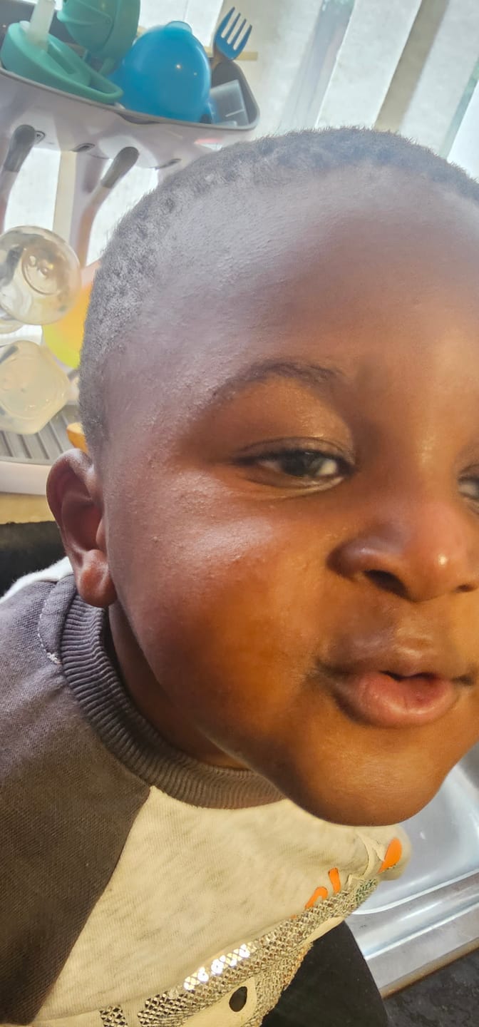 Customer photo review of Bioskin Junior Daily Face Moisturiser