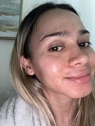 Customer photo review of CicaPure™ Cleansing Foam