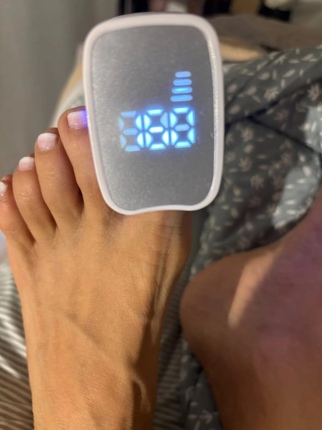 Customer photo review of Dispositivo Láser Micoval