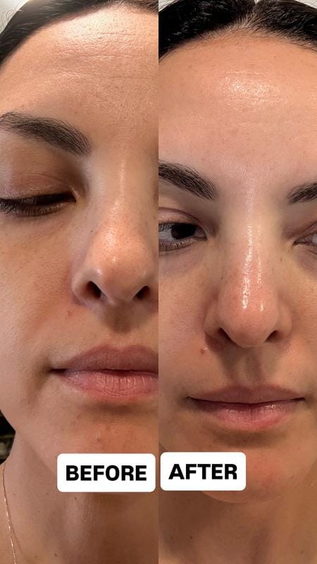 Customer photo review of Instant FIRMx® Peter Thomas Roth Tensor de Ojos Temporal