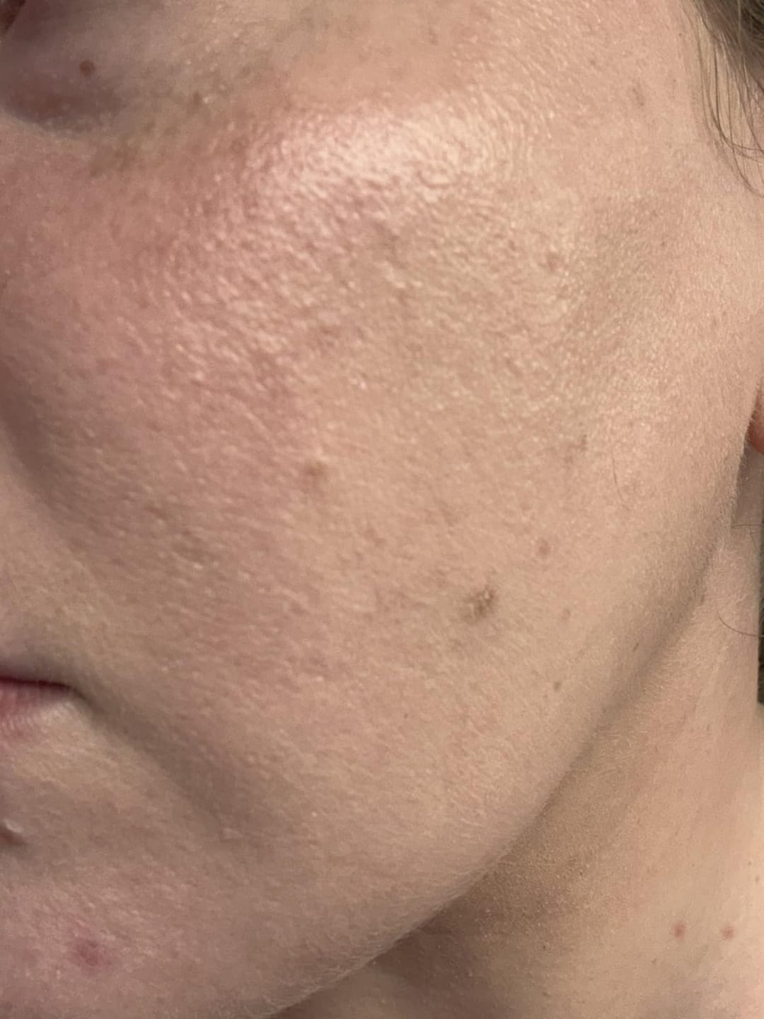Customer photo review of TrueTone CC Serum
