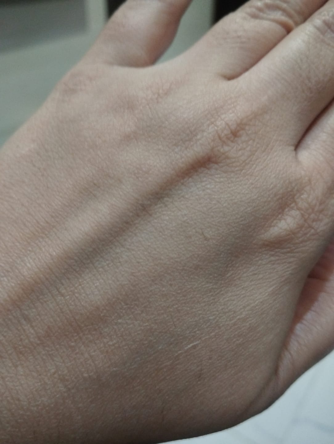 Customer photo review of Melaplex Cream