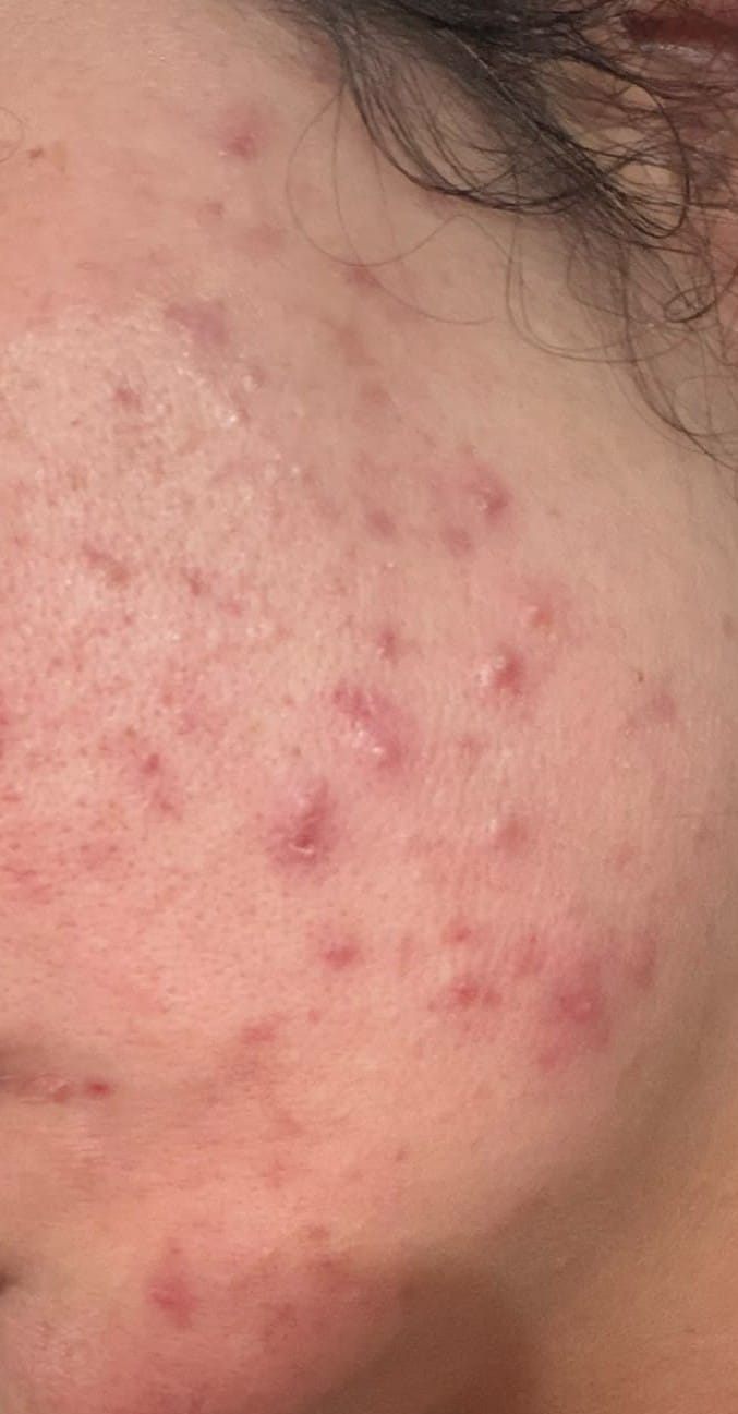 Customer photo review of A CONTROL + CORTIZEN - Equilibrio hormonal desde el cerebro, los ovarios, la piel y el metabolismo.