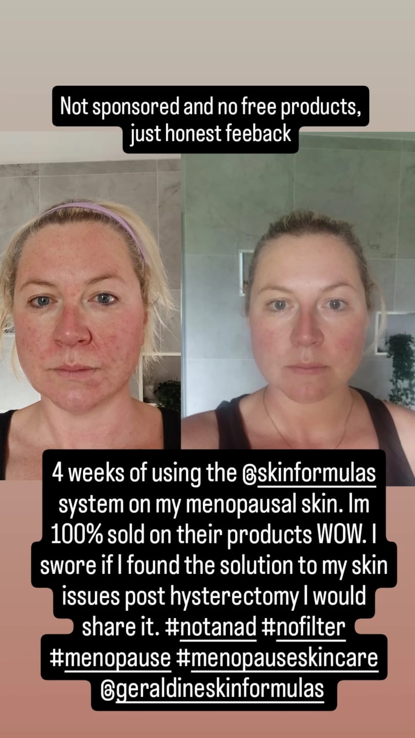 Customer photo review of Clear Skin Treatment