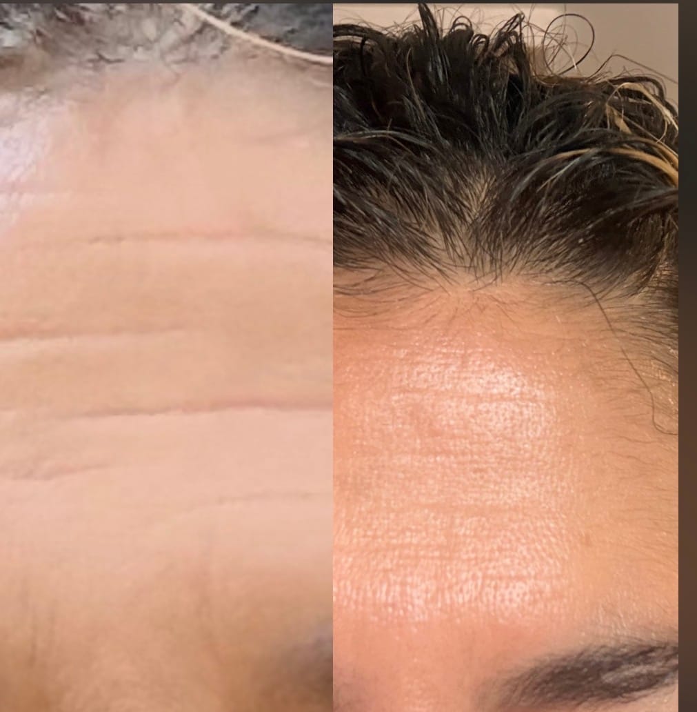 Customer photo review of Ageless Cloud Cream