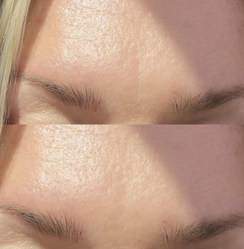 Customer photo review of Instant FIRMx® Peter Thomas Roth Tensor de Ojos Temporal