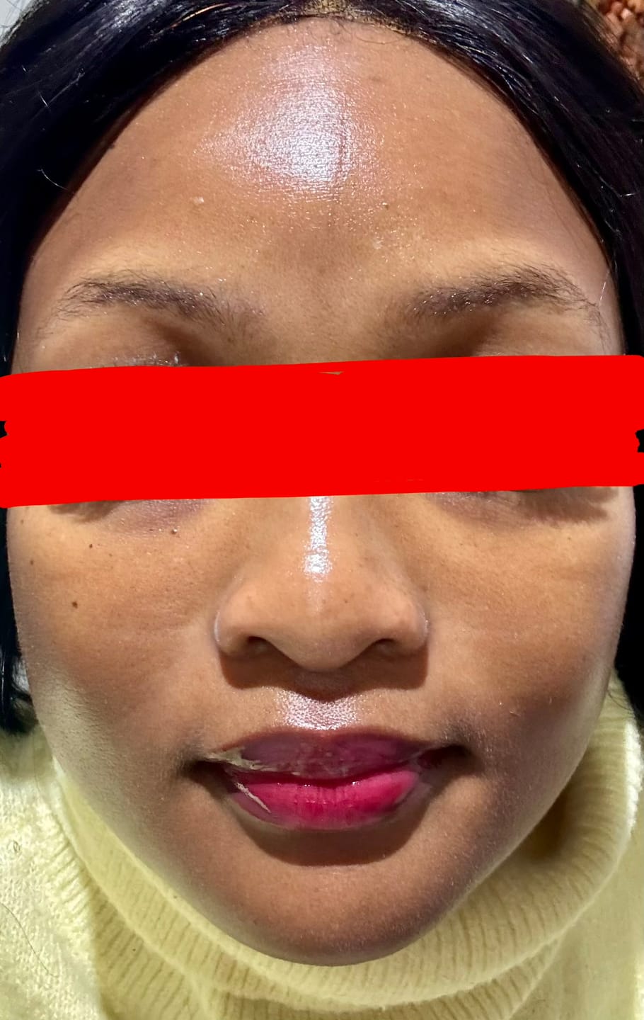 Customer photo review of OceaGlow Marine Collagen