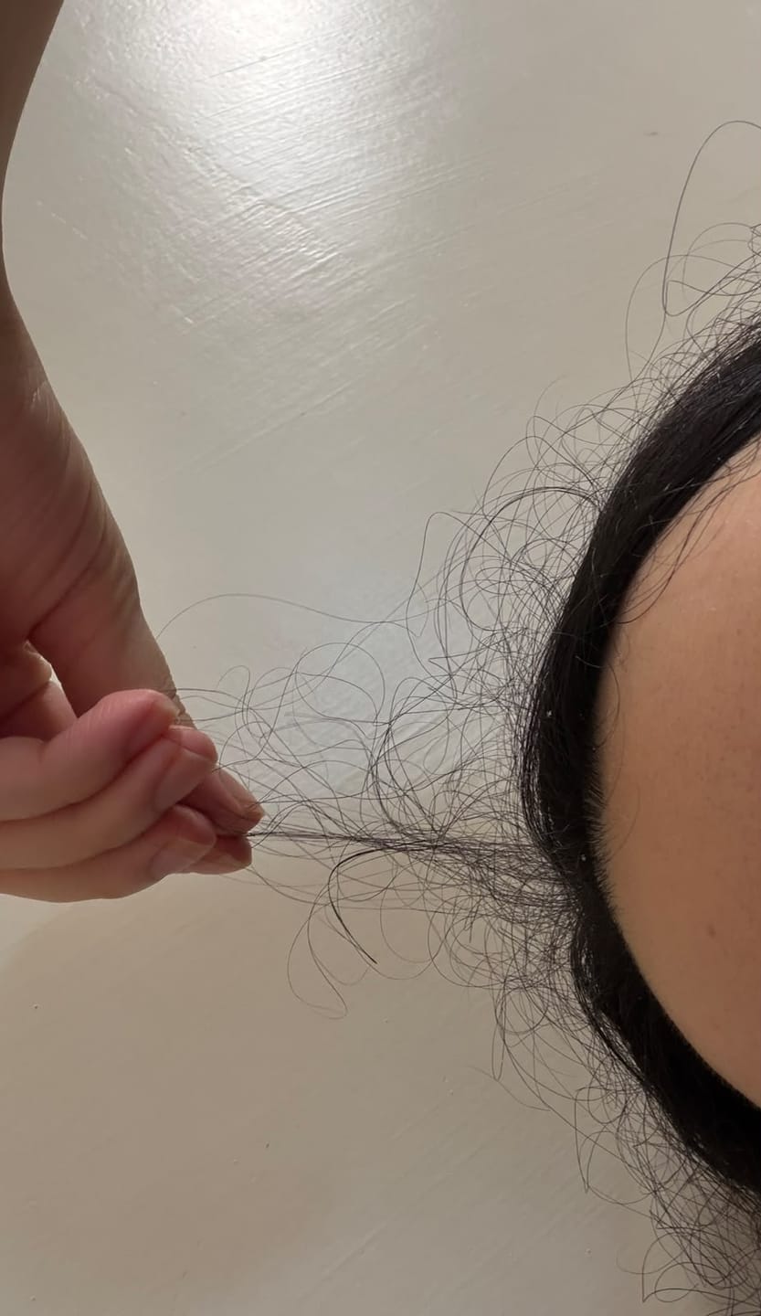 Customer photo review of VITAFOAM ™ Hair Growth Formula