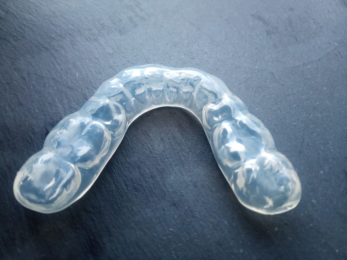 Customer photo review of 3.0mm Soft Night Guards
