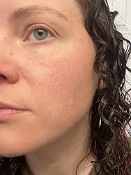 Customer photo review of CicaPure™ Cleansing Foam