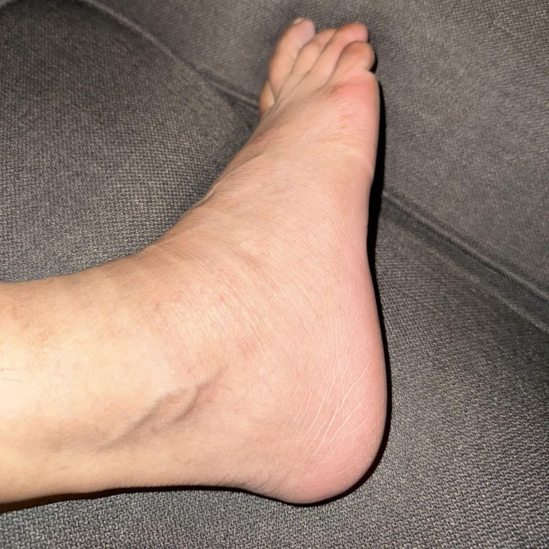 Customer photo review of Planta Compression Socks
