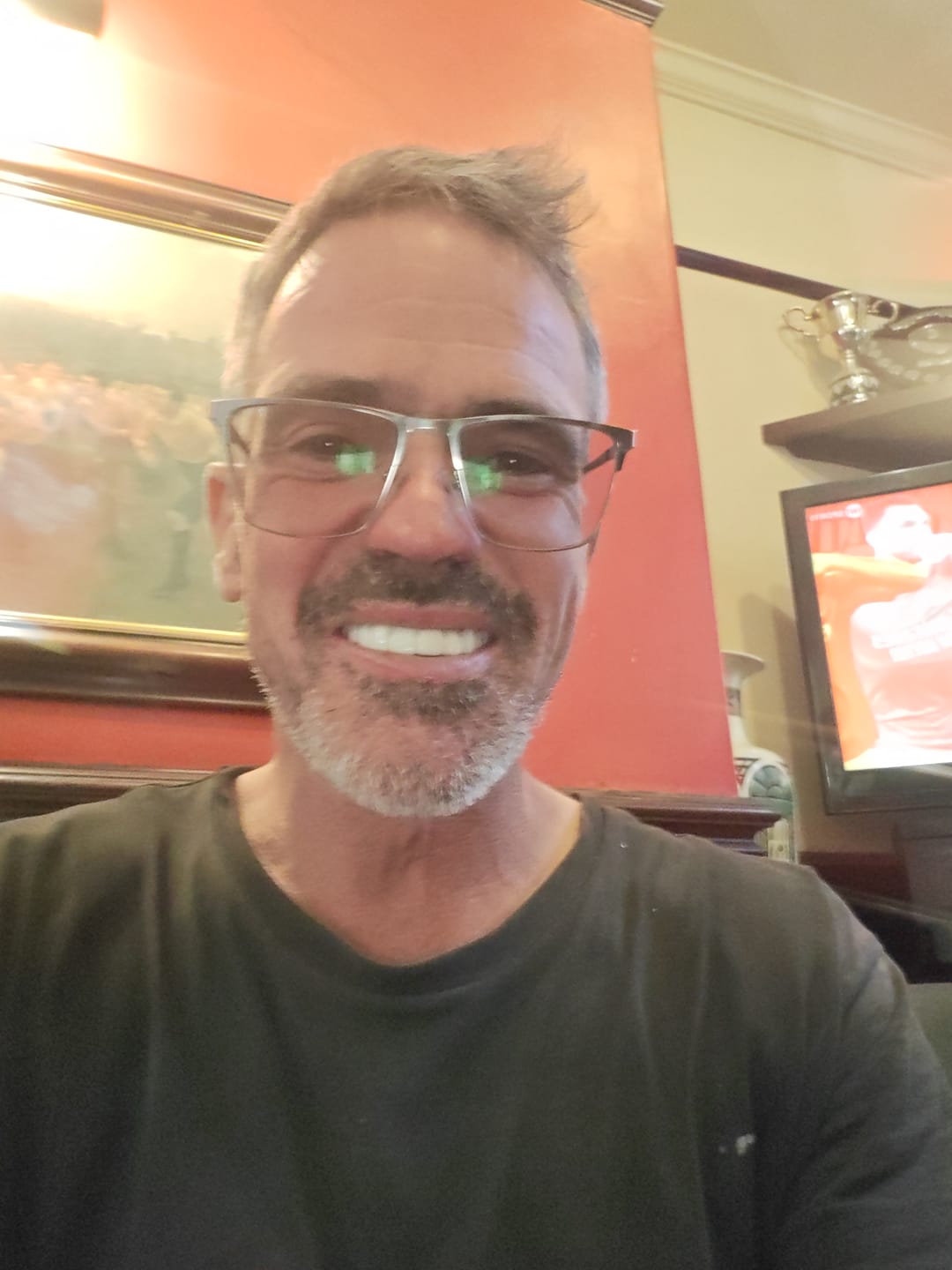 Customer photo review of Click-in Veneers 4.0