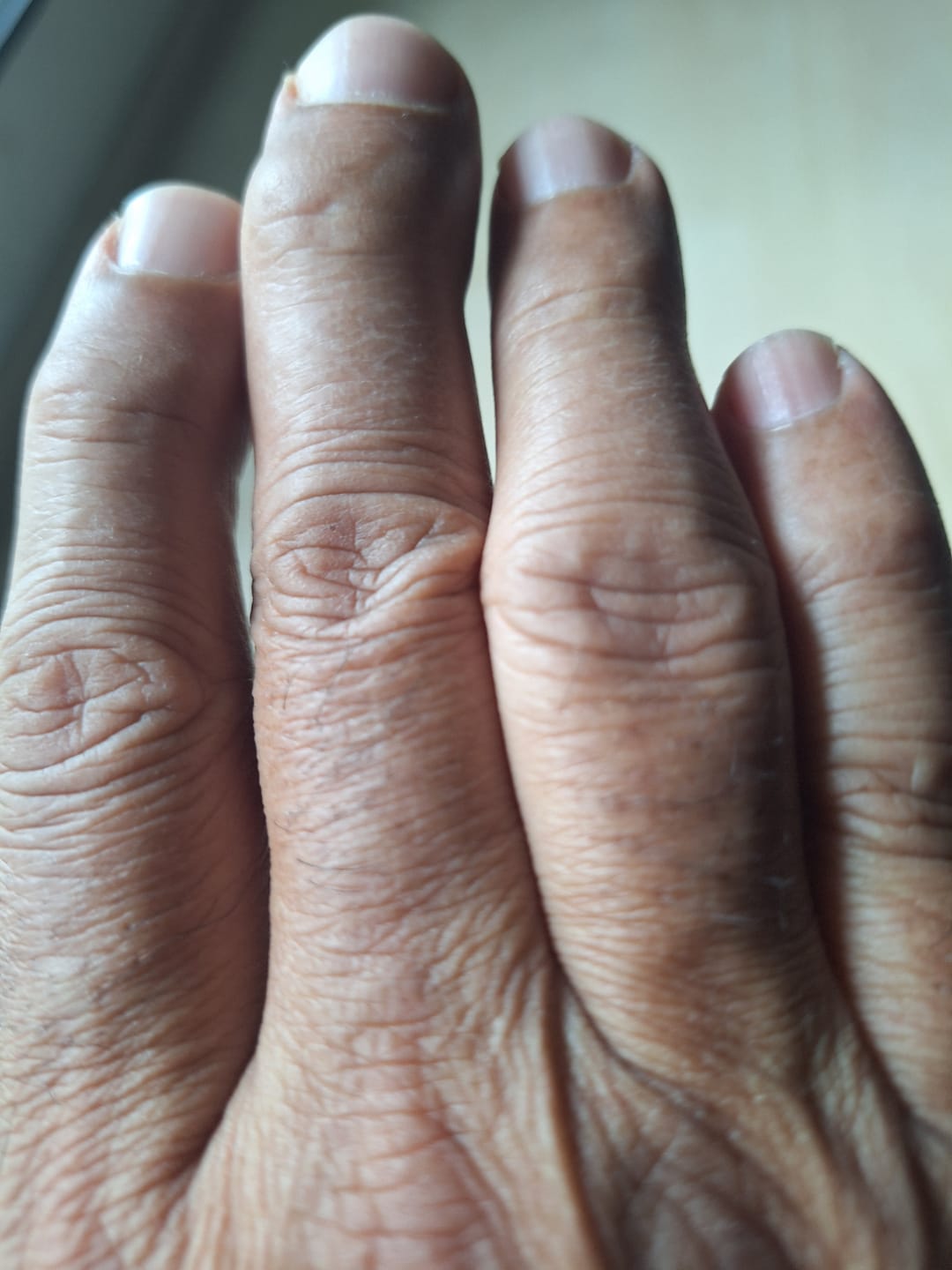 Customer photo review of Uric Acid Support Free Bottles Offer