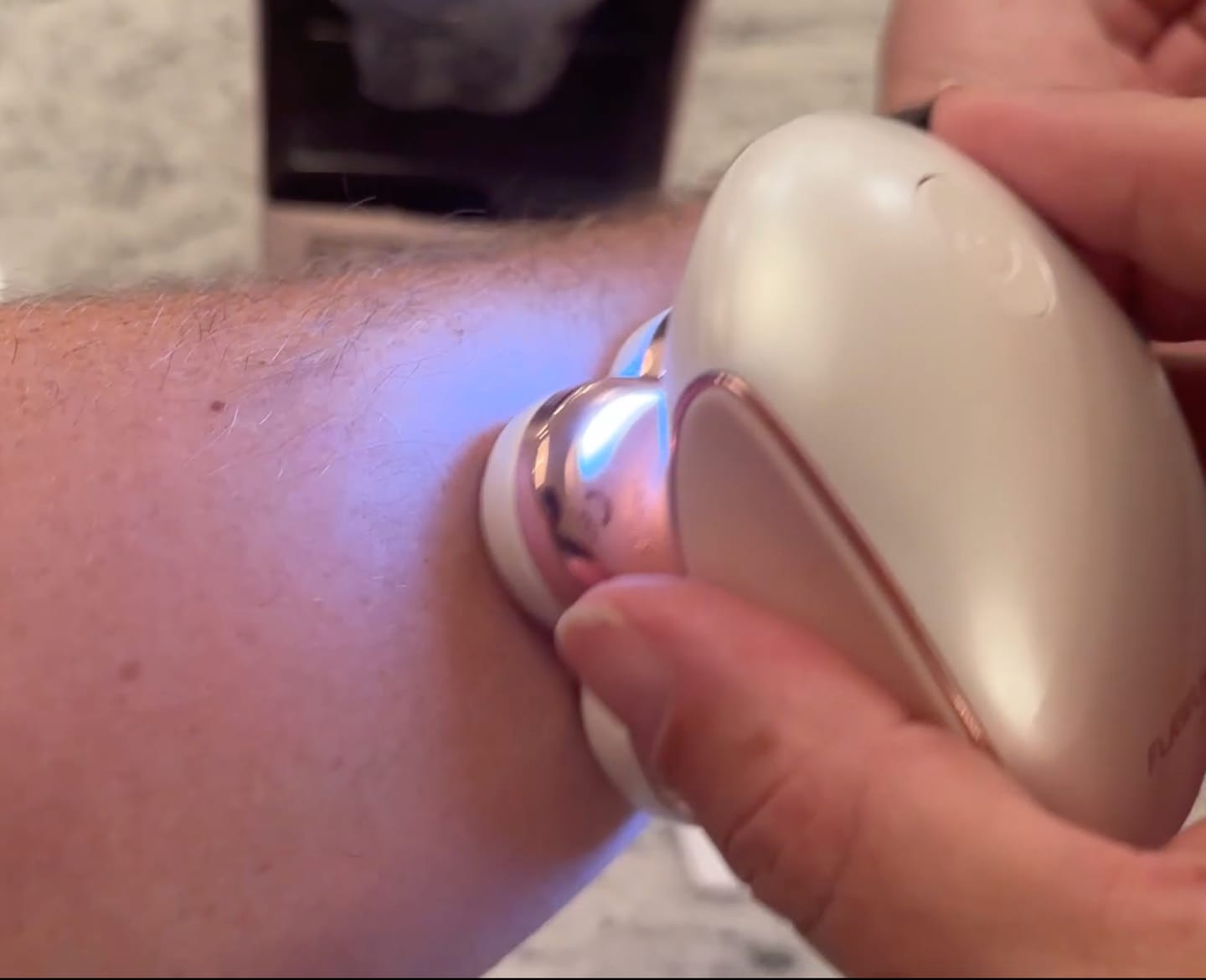 Customer photo review of Bump-Free Shaver
