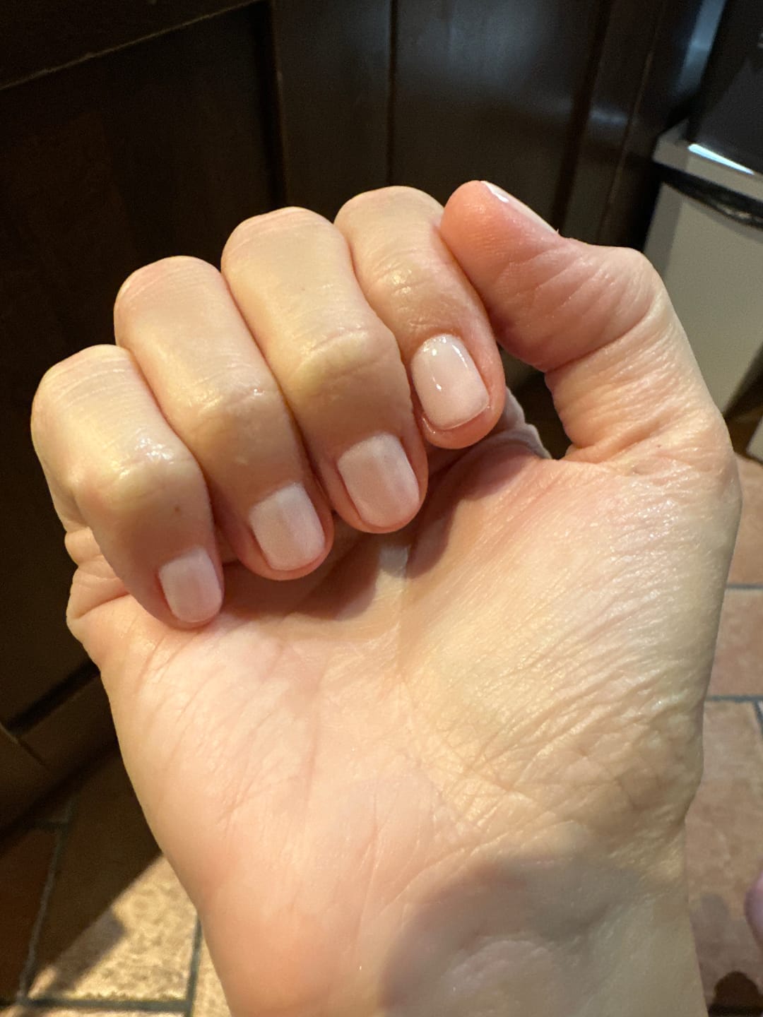 Customer photo review of LCI Combo Pack: Base Coat 10 ml + Top Coat 10 ml