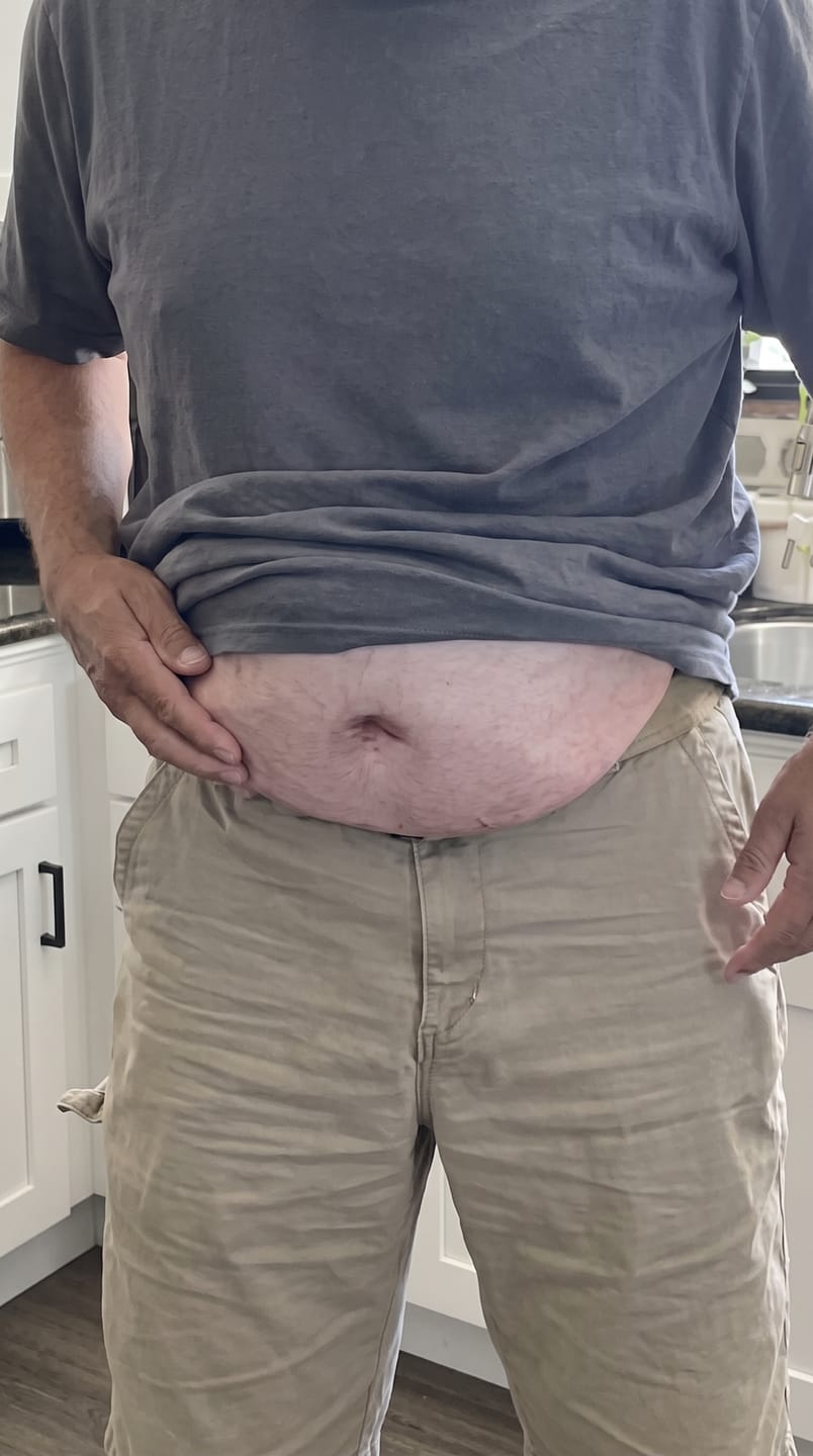 Customer photo review of BellyGap™ — Riñonera con estampado de barriga