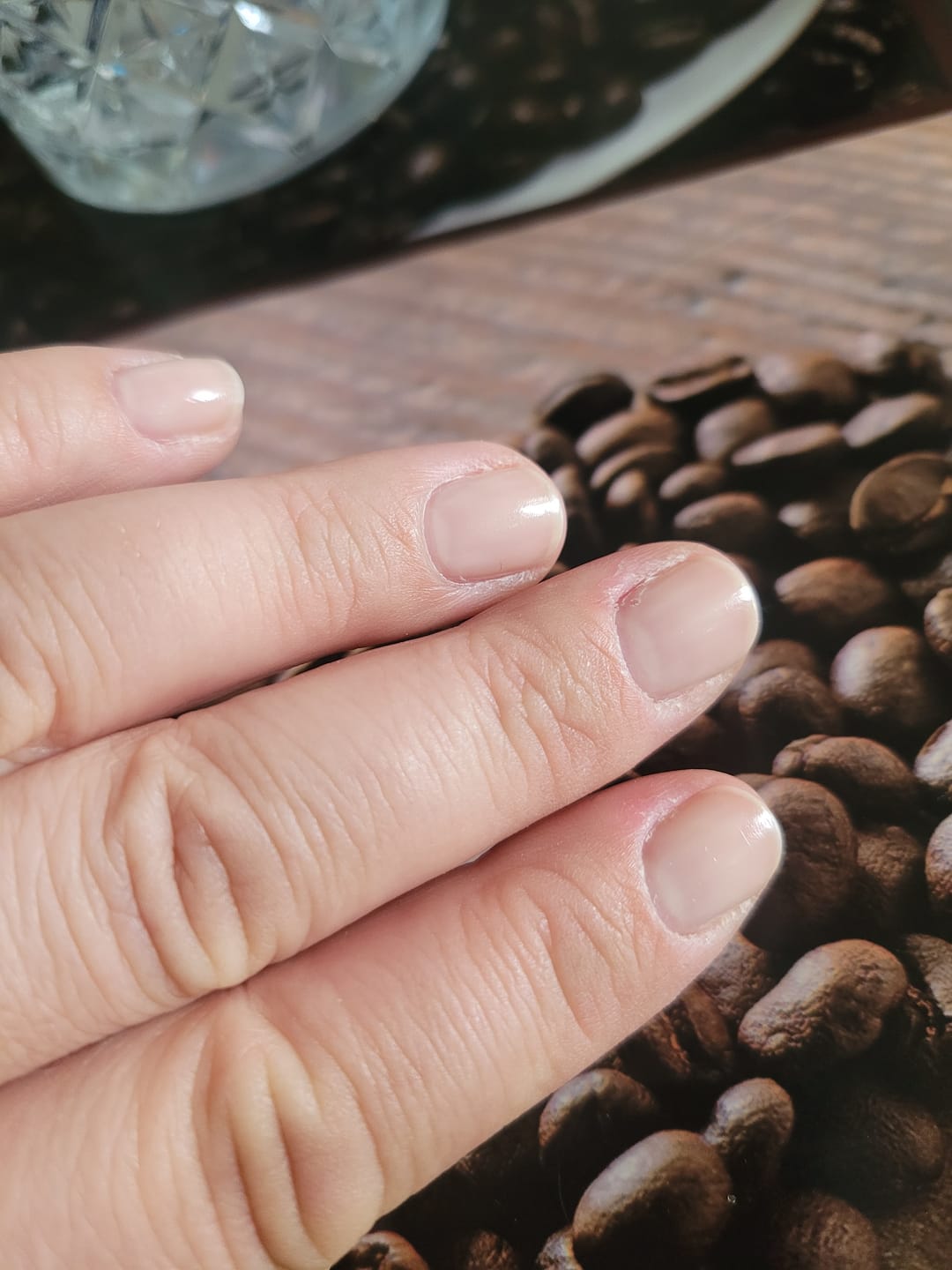 Customer photo review of Semilac Rescue Care Nail Conditioner 7ml