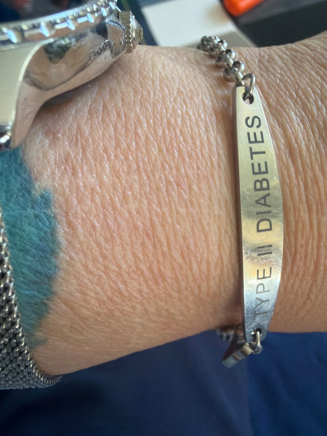 Customer photo review of Diabetes-Bewusstseins-Armband
