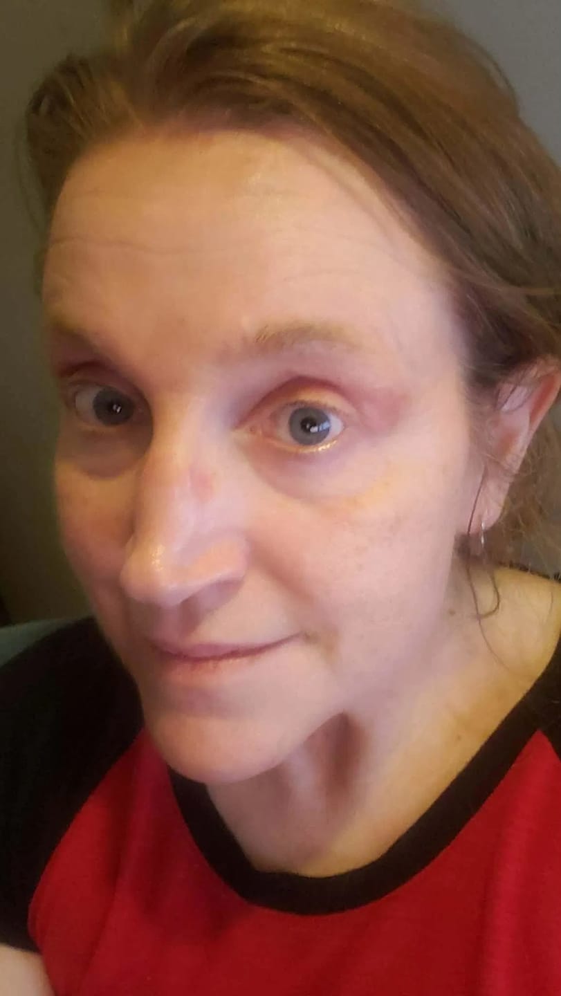 Customer photo review of COLLAGEN MASK